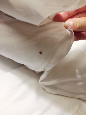 Bettwanzen: Ungebetene Gäste im Schlafzimmer - Bettwanzen: Ungebetene Gäste im Schlafzimmer